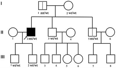 Case report: A variant of the FIG4 gene with rapidly progressive amyotrophic lateral sclerosis